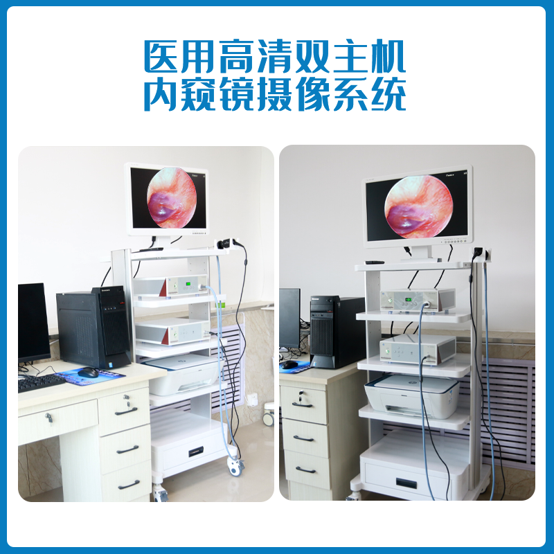 医用耳鼻喉内窥镜摄像系统优势